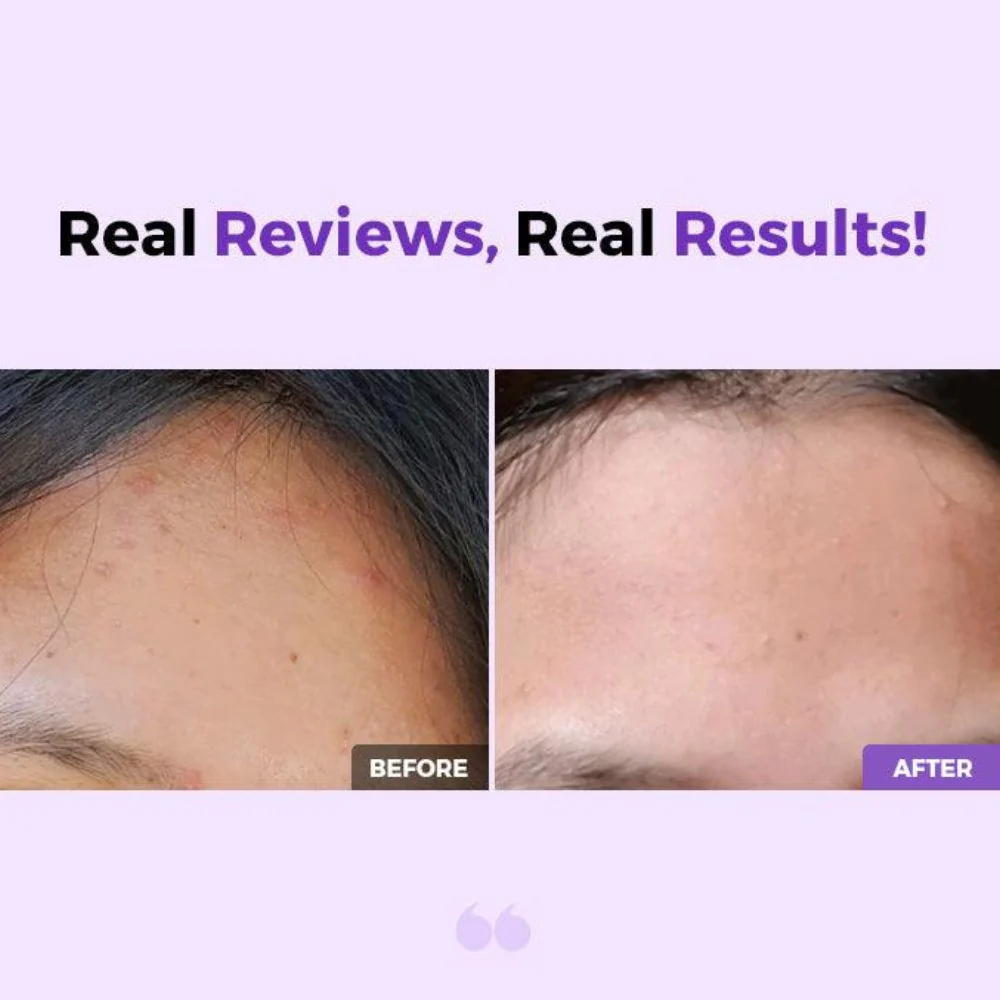 تونر كوزركس احماض -  150مل | Cosrx AHA/BHA Clarifying Treatment Toner - Image 3